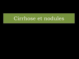 Cirrhose et nodules