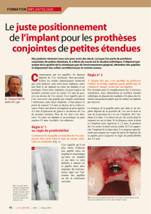 Le juste positionnement del`implant pour lesprothèses