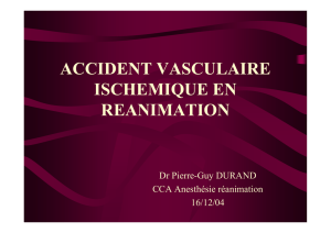 accident vasculaire ischemique en reanimation