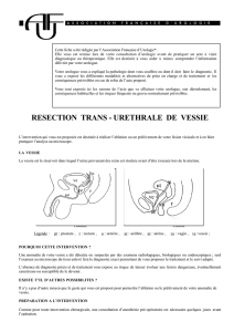RESECTION TRANS - URETHRALE DE VESSIE