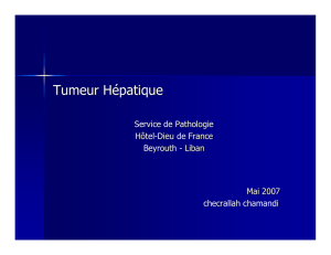 Tumeur Hépatique