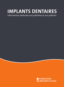 implants dentaires