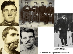 1. Mutilés et « gueules cassées » André Maginot