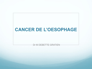 CANCER DE L`OESOPHAGE