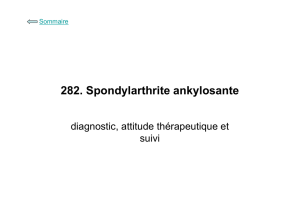 282. Spondylarthrite ankylosante : diagnostic, attitude thérapeutique