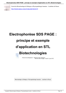 Electrophorèse SDS PAGE : principe et exemple d