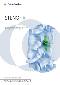 STENOFIX