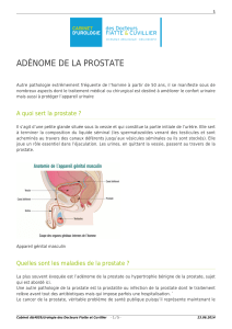 adénome de la prostate - Cabinet d`Urologie des Docteurs Fiatte et