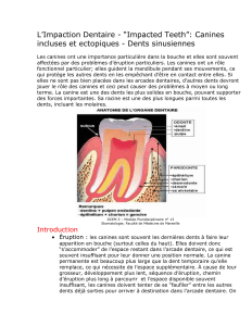 Canines incluses et ectopiques - Dents sinusiennes