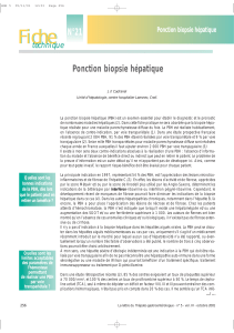 Ponction biopsie hépatique