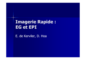 Imagerie Rapide EG EPI DES