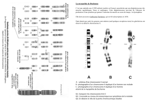 La myopathie de Duchenne A : schéma d`un chromosome X normal