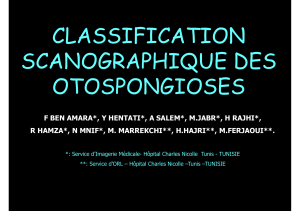 CLASSIFICATION SCANOGRAPHIQUE DES OTOSPONGIOSES