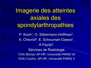 Imagerie des atteintes axiales des spondylarthropathies