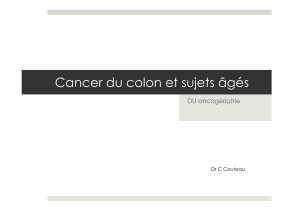 Cancer du colon et sujets âgés