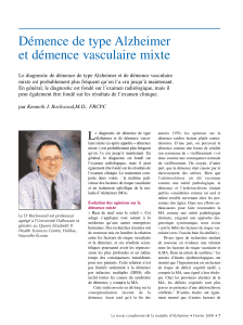 Démence de type Alzheimer et démence vasculaire mixte