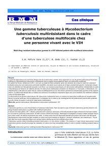 Une gomme tuberculeuse à Mycobacterium tuberculosis