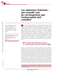 Les ade´nomes festonne´s : une nouvelle voie de carcinogene`se