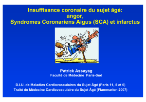 Insuffisance coronaire du sujet âgé: angor, Syndromes Coronariens Aigus (SCA) et infarctus