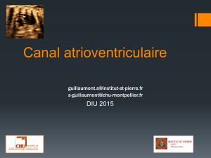 Canal atrioventriculaire  DIU 2015