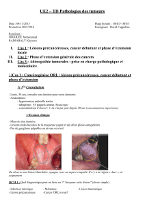 UE2 – TD Pathologies des tumeurs