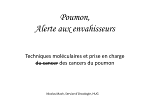 Poumon, Alerte aux envahisseurs Techniques moléculaires et prise en charge  du cancer des cancers du poumon