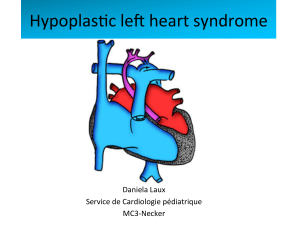 DIU Anesthésie Réanimation des Cardiopathies Congénitales-Hypoplasie du coeur gauche