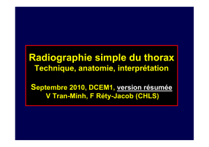Radiographie simple du thorax Technique, anatomie, interprétation S eptembre 2010, DCEM1,