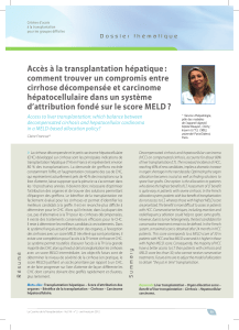 Accès à la transplantation hépatique : comment trouver un compromis entre