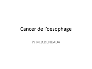 Cancer de l’oesophage Pr M.B.BENKADA