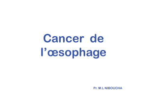 Cancer  de l’œsophage Pr. M.L NIBOUCHA