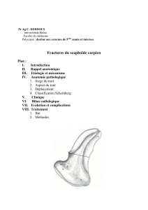 Fractures du scaphoïde carpien