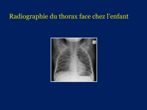 Radiographie du thorax face chez l’enfant