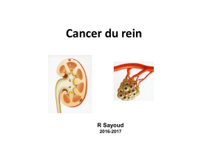 Cancer du rein R Sayoud 2016-2017