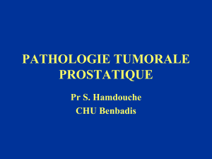 PATHOLOGIE TUMORALE PROSTATIQUE Pr S. Hamdouche CHU Benbadis