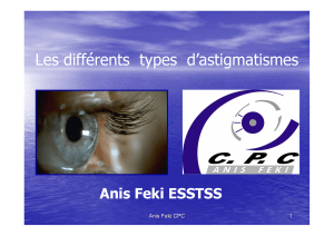 Les différents  types  d’astigmatismes Anis Feki ESSTSS Anis Feki CPC 1