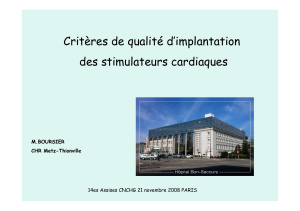 Critères de qualité d’implantation des stimulateurs cardiaques M.BOURSIER CHR Metz-Thionville