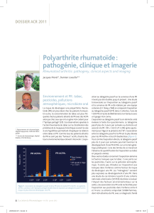 Polyarthrite rhumatoïde : pathogénie, clinique et imagerie DOSSIER ACR 2011