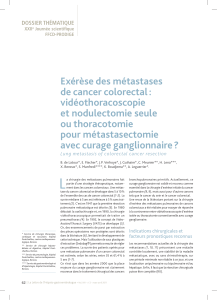 Exérèse des métastases de cancer colorectal : vidéothoracoscopie et nodulectomie seule