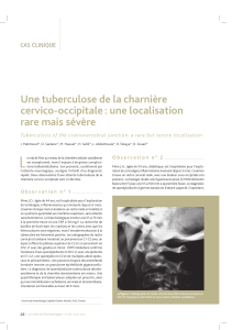 L Une tuberculose de la charnière cervico-occipitale : une localisation rare mais sévère