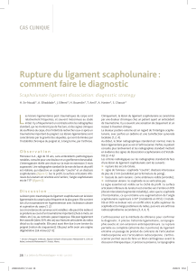 L Rupture du ligament scapholunaire : comment faire le diagnostic CAS CLInIQUE