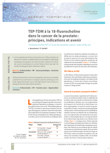 TEP-TDM à la 18-fluorocholine dans le cancer de la prostate :