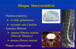 Disque  Intervertébral