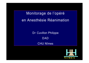 Monitorage de l’opéré en Anesthésie Réanimation Dr Cuvillon Philippe DAD