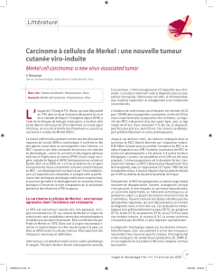 Carcinome à cellules de Merkel : une nouvelle tumeur cutanée viro-induite Littérature