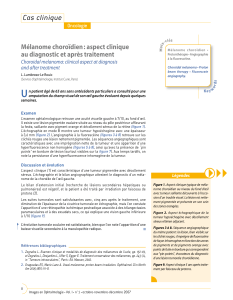 U Cas clinique Mélanome choroïdien : aspect clinique au diagnostic et après traitement