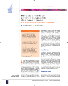 Biopsies guidées pour le diagnostic des lymphomes