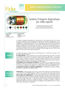 Fiche N°25 Système d’imagerie diagnostique par vidéo-capsule