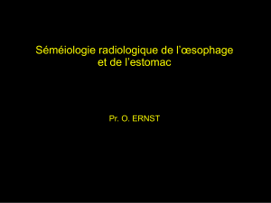 Imagerie oesophage 2016.ppt