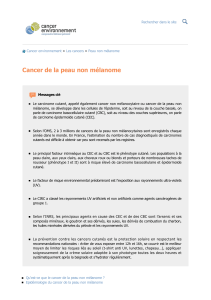Cancer&nbsp;de&nbsp;la&nbsp;peau&nbsp;non&nbsp;m&eacute;lanome